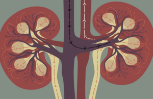 Dialysis Kidney Process Dialysis kidney process like?